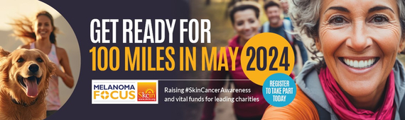 100 Miles in May Supporting Skcin & Melanoma Focus